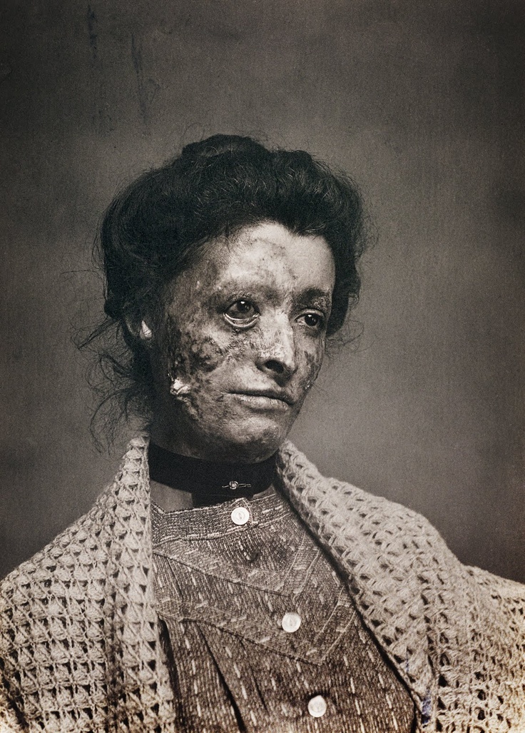 Ongebruikt Victorian Post-Mortem Photography | History Undusted OC-61